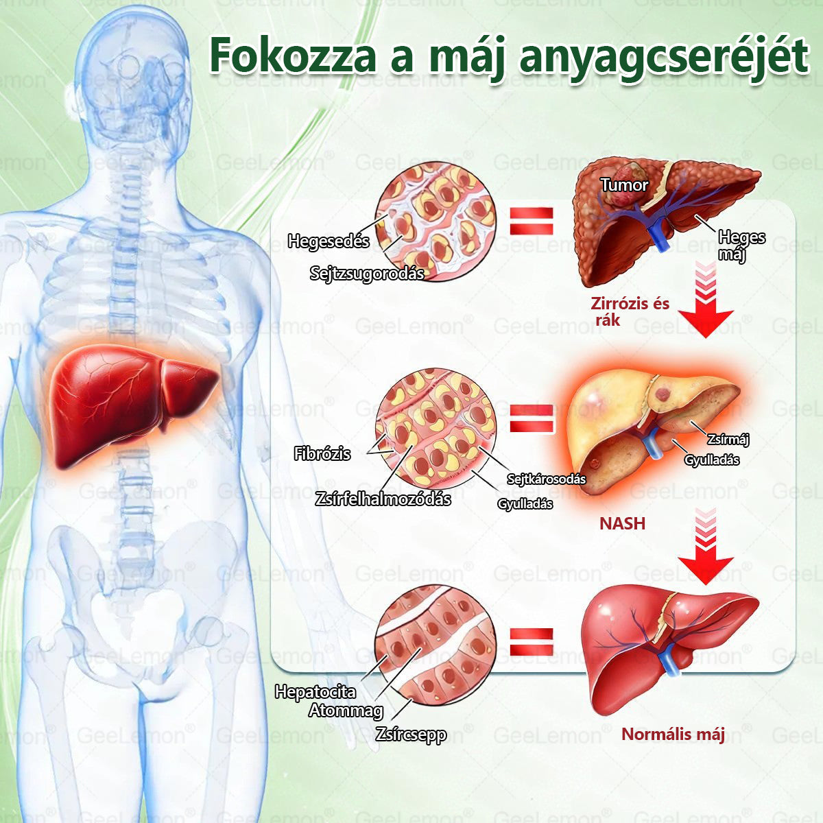 🎡 Hivatalos tanúsítás🔥 Több ezer elégedett felhasználó Magyarországon| 🤍𝐆𝐞𝑒𝐿𝑒𝐦𝐨𝐧® Glumasetide 10 az 1-ben Karcsú és Egészséges Nano Mikrotűs Tapasz 🇭🇺