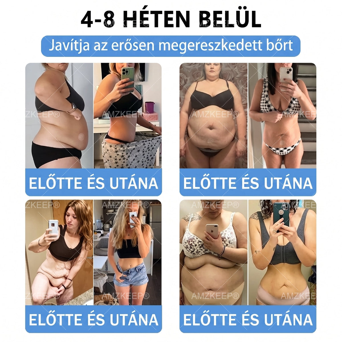 🏥💯𝐀𝗠𝒁𝑲𝗘𝑬𝙋® 𝐀𝗠𝗣𝑲𝐌𝗼𝗿𝗶𝗻𝗴𝗮𝐁𝗲𝗿𝗯𝗲𝗿𝗶𝗻 𝟏𝟎-𝗮𝘇-𝟏 𝐌𝗲𝘁𝗮𝗯𝗼𝗹𝗶𝗸𝘂𝘀 𝐓á𝗺𝗼𝗴𝗮𝘁á𝘀 𝐍𝗮𝗻𝗼 𝐌𝗶𝗸𝗿𝗼𝘁ű𝘀 𝐓𝗮𝗽𝗮𝘀𝘇 🇭🇺 (𝗡𝗮𝗽𝗼𝗻𝘁𝗮 𝗲𝗴𝘆𝘀𝘇𝗲𝗿𝗶 𝗵𝗮𝘀𝘇𝗻á𝗹𝗮𝘁, 𝗹á𝘁𝘃á𝗻𝘆𝗼𝘀 𝘃á𝗹𝘁𝗼𝘇á𝘀 𝟳 𝗻𝗮𝗽 𝗮𝗹𝗮𝘁𝘁) ✅ 𝗧ú𝗹𝘀ú𝗹𝘆, 𝗹𝗮𝘇𝗮 𝗯ő𝗿, 𝘃é𝗿𝗰𝘂𝗸𝗼𝗿-𝗲𝗴𝘆𝗲𝗻𝘀ú𝗹𝘆, 𝗮𝗹𝘃á𝘀𝗶 𝗽𝗿𝗼𝗯𝗹é𝗺á𝗸, í𝘇ü𝗹𝗲𝘁𝗶 𝗽𝗮𝗻𝗮𝘀𝘇𝗼𝗸 é𝘀 𝗲𝗴𝘆é𝗯 𝘁𝗲𝗿ü𝗹𝗲𝘁𝗲𝗸 𝘁á𝗺𝗼𝗴𝗮𝘁á𝘀á𝗿𝗮