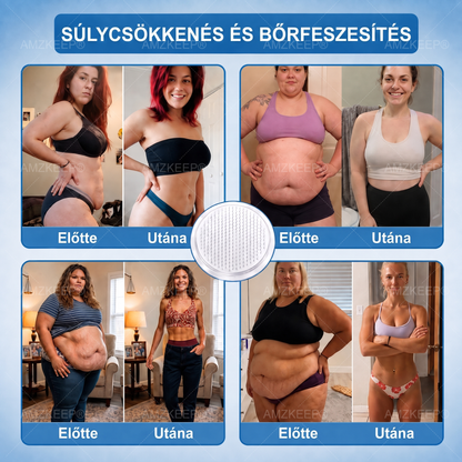 🏥💯𝐀𝗠𝒁𝑲𝗘𝑬𝙋® 𝐀𝗠𝗣𝑲𝐌𝗼𝗿𝗶𝗻𝗴𝗮𝐁𝗲𝗿𝗯𝗲𝗿𝗶𝗻 𝟏𝟎-𝗮𝘇-𝟏 𝐌𝗲𝘁𝗮𝗯𝗼𝗹𝗶𝗸𝘂𝘀 𝐓á𝗺𝗼𝗴𝗮𝘁á𝘀 𝐍𝗮𝗻𝗼 𝐌𝗶𝗸𝗿𝗼𝘁ű𝘀 𝐓𝗮𝗽𝗮𝘀𝘇 🇭🇺 (𝗡𝗮𝗽𝗼𝗻𝘁𝗮 𝗲𝗴𝘆𝘀𝘇𝗲𝗿𝗶 𝗵𝗮𝘀𝘇𝗻á𝗹𝗮𝘁, 𝗹á𝘁𝘃á𝗻𝘆𝗼𝘀 𝘃á𝗹𝘁𝗼𝘇á𝘀 𝟳 𝗻𝗮𝗽 𝗮𝗹𝗮𝘁𝘁) ✅ 𝗧ú𝗹𝘀ú𝗹𝘆, 𝗹𝗮𝘇𝗮 𝗯ő𝗿, 𝘃é𝗿𝗰𝘂𝗸𝗼𝗿-𝗲𝗴𝘆𝗲𝗻𝘀ú𝗹𝘆, 𝗮𝗹𝘃á𝘀𝗶 𝗽𝗿𝗼𝗯𝗹é𝗺á𝗸, í𝘇ü𝗹𝗲𝘁𝗶 𝗽𝗮𝗻𝗮𝘀𝘇𝗼𝗸 é𝘀 𝗲𝗴𝘆é𝗯 𝘁𝗲𝗿ü𝗹𝗲𝘁𝗲𝗸 𝘁á𝗺𝗼𝗴𝗮𝘁á𝘀á𝗿𝗮
