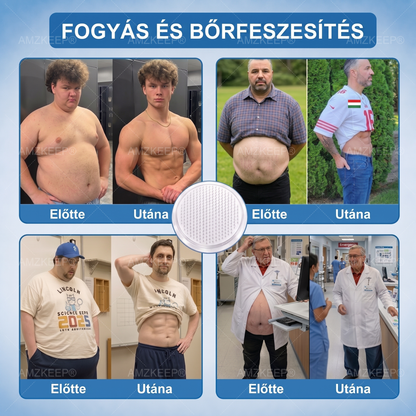 🏥💯𝐀𝗠𝒁𝑲𝗘𝑬𝙋® 𝐀𝗠𝗣𝑲𝐌𝗼𝗿𝗶𝗻𝗴𝗮𝐁𝗲𝗿𝗯𝗲𝗿𝗶𝗻 𝟏𝟎-𝗮𝘇-𝟏 𝐌𝗲𝘁𝗮𝗯𝗼𝗹𝗶𝗸𝘂𝘀 𝐓á𝗺𝗼𝗴𝗮𝘁á𝘀 𝐍𝗮𝗻𝗼 𝐌𝗶𝗸𝗿𝗼𝘁ű𝘀 𝐓𝗮𝗽𝗮𝘀𝘇 🇭🇺 (𝗡𝗮𝗽𝗼𝗻𝘁𝗮 𝗲𝗴𝘆𝘀𝘇𝗲𝗿𝗶 𝗵𝗮𝘀𝘇𝗻á𝗹𝗮𝘁, 𝗹á𝘁𝘃á𝗻𝘆𝗼𝘀 𝘃á𝗹𝘁𝗼𝘇á𝘀 𝟳 𝗻𝗮𝗽 𝗮𝗹𝗮𝘁𝘁) ✅ 𝗧ú𝗹𝘀ú𝗹𝘆, 𝗹𝗮𝘇𝗮 𝗯ő𝗿, 𝘃é𝗿𝗰𝘂𝗸𝗼𝗿-𝗲𝗴𝘆𝗲𝗻𝘀ú𝗹𝘆, 𝗮𝗹𝘃á𝘀𝗶 𝗽𝗿𝗼𝗯𝗹é𝗺á𝗸, í𝘇ü𝗹𝗲𝘁𝗶 𝗽𝗮𝗻𝗮𝘀𝘇𝗼𝗸 é𝘀 𝗲𝗴𝘆é𝗯 𝘁𝗲𝗿ü𝗹𝗲𝘁𝗲𝗸 𝘁á𝗺𝗼𝗴𝗮𝘁á𝘀á𝗿𝗮