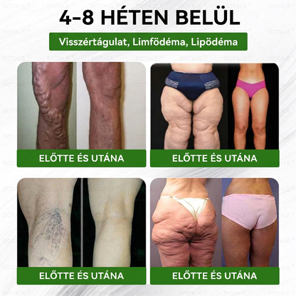 🚀 DOTALE Metabolic Nano Microneedle Patch (Naponta mindössze egyszeri használat · Látható változások akár 7 nap alatt)