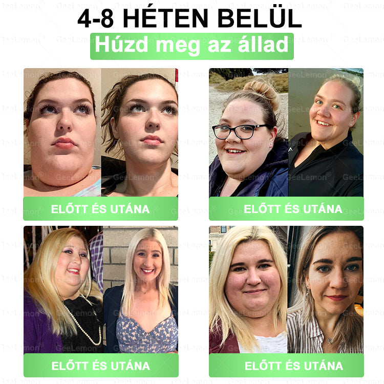 🎡 Hivatalos tanúsítás🔥 Több ezer elégedett felhasználó Magyarországon| 🤍𝐆𝐞𝑒𝐿𝑒𝐦𝐨𝐧® Glumasetide 10 az 1-ben Karcsú és Egészséges Nano Mikrotűs Tapasz 🇭🇺