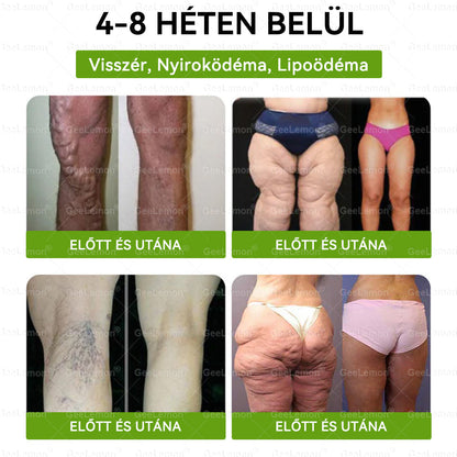 🎡 Hivatalos tanúsítás🔥 Több ezer elégedett felhasználó Magyarországon| 🤍𝐆𝐞𝑒𝐿𝑒𝐦𝐨𝐧® Glumasetide 10 az 1-ben Karcsú és Egészséges Nano Mikrotűs Tapasz 🇭🇺